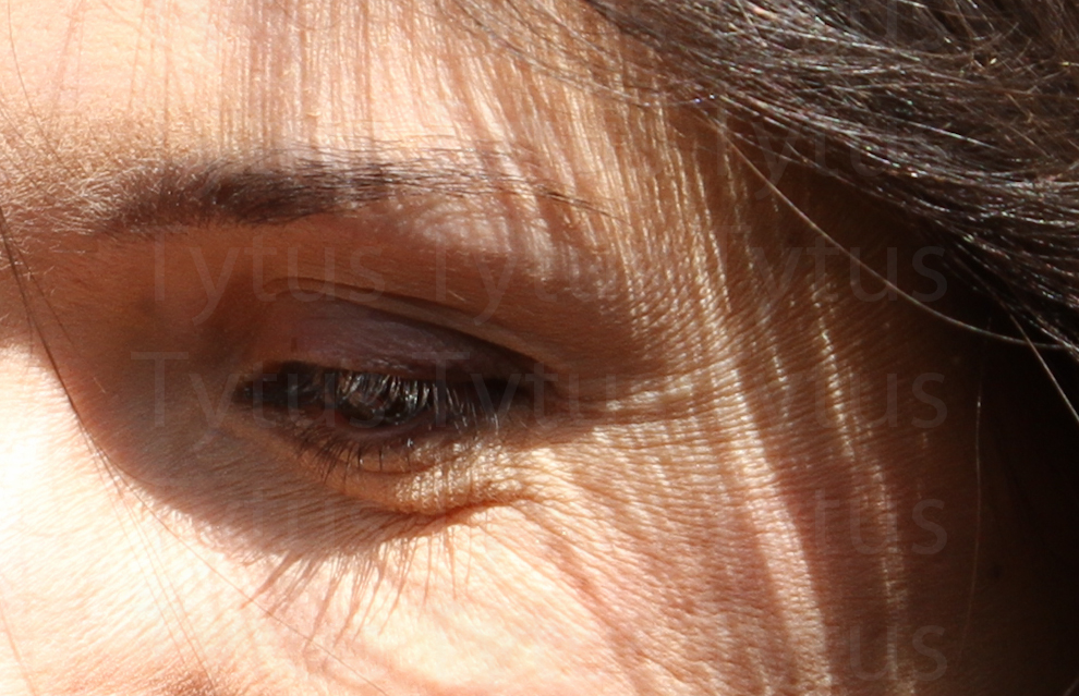 An eye